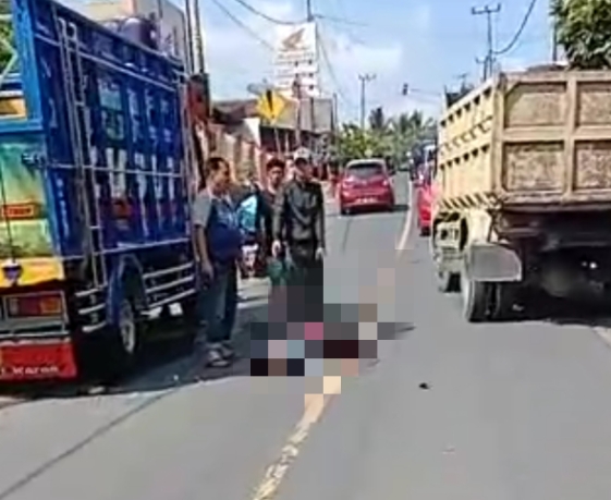 Pengendara Motor MD Setelah Tabrak Pantat Truck