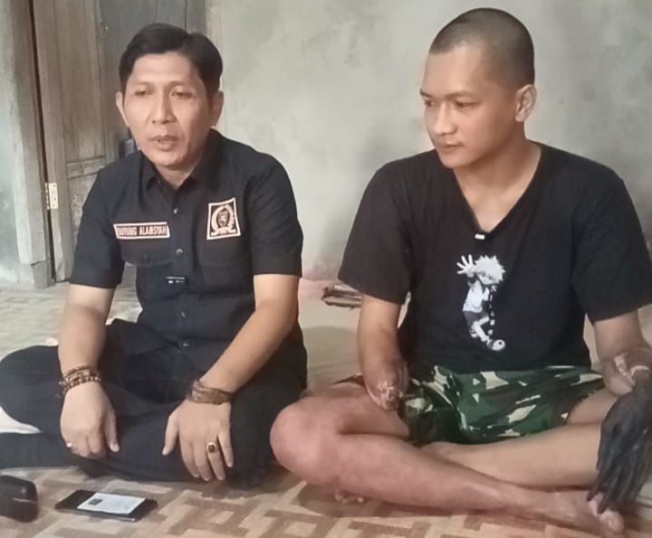 Korban Sengatan Listrik Harapkan Bantuan Tangan Palsu
