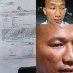 Ketua AWPI TUBABA Kecam Dugaan Penganiayaan Terhadap Anggotanya Dan Desak Polisi Usat Tuntas